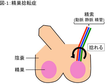 金玉 左右 大き さ 違う