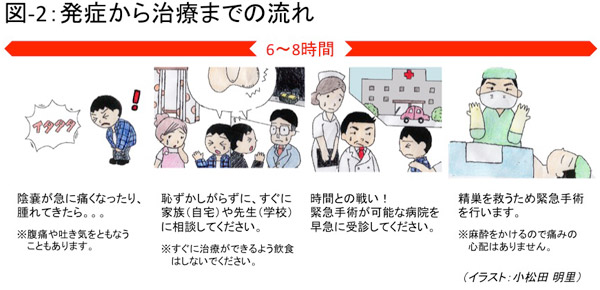 ねじれ 金玉 睾丸の腫れや痛みを治す 3つの方法